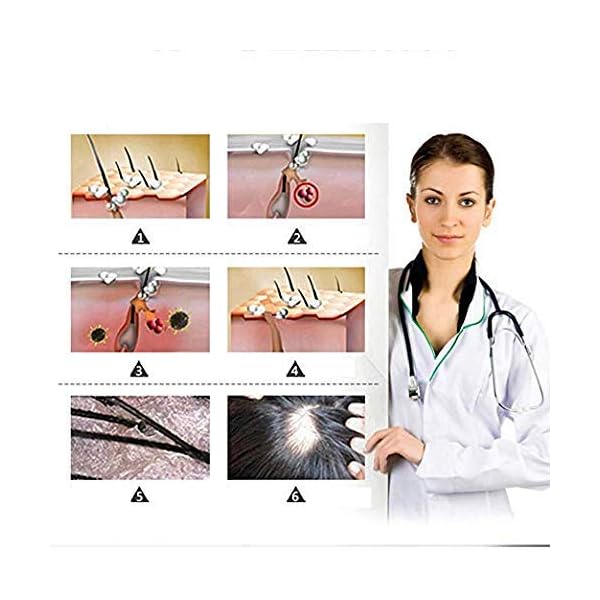 Ginger Germinal Oil, Hair Growth Oil, Hair Growth Serum, Ginger Germinal Essential Oil, Hair Loss Treatment Hair Care…