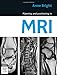Planning and Positioning in MRI