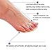 Price Xes Toe Splint & Straightener, Adjustable Loops Hammer Toe Correctors Brace w/Slip-on Cushion Metatarsal Pads for Claw Curled & Crooked Toes - Support Guard for Pre Post Surgery (3 loops right)