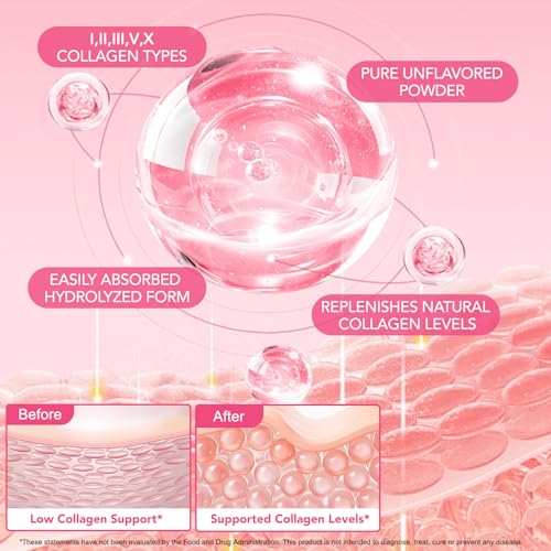 Multi Collagen Peptides Powder, 1 lb Unflavored Hydrolyzed Collagen Types I, II, III, V, X，16 oz (41 Servings)-Hyaluronic Acid Power,Grass Fed Collagen Supplements for Women and Men, Non GMO