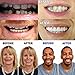 Perfect Smile Veneers Cosmetic Teeth Veneer Dentures for Woman and Man, One Size Fit All (Teeth upper)