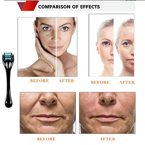 Derma Roller Kit for Face 0.25mm - Microneedle Roller Microdermabrasion Device Tool -Mini Skin Care 540 Titanium Micro Needles Roller System with Gift Box and Crystal Case (0.25mm, Black&Blue)
