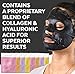 Face Mask for Korean Skincare – Sheet Mask for Detoxifying, Cleansing, Moisturizing and Brightening Skin | Dermatologist Tested Charcoal Face Mask with Collagen & Hyaluronic Acid for Soft Skin, 8 Packthumb 3