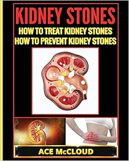 Kidney Stones How To Treat Kidney Stones How To Prevent Kidney Stones Kidney Stone Treatment Prevention Guide With All Amazon Co Uk Mccloud Ace 9781640480469 Books