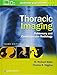 Thoracic Imaging: Pulmonary and Cardiovascular Radiology
