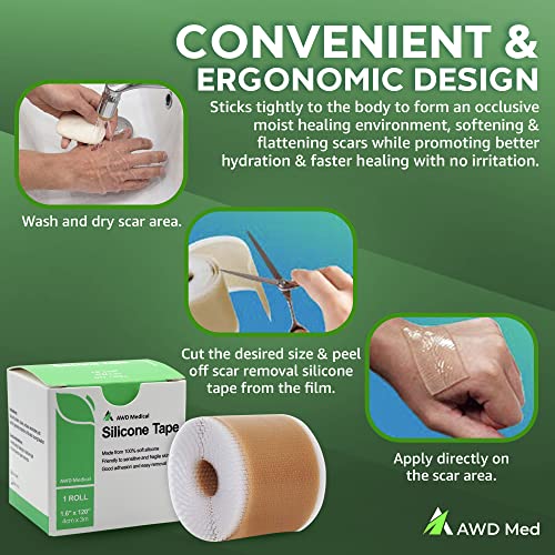 AWD Silicone Scar Tape for Surgical Scars Medical Grade Silicone Scar Sheets for C Section