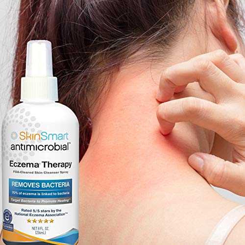 SkinSmart Eczema Therapy Removes Bacteria so Skin Can Heal, 8 Ounce Clear Spray and Safe for Babies, Kids, Adults and Seniors