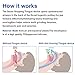 MORPHEUS MAX Anti Snoring Tongue Device Transparent Clear Silicone Tongue Tube 2019 Upgrade Soft Silicone Mouth Type Anti-Snoring Sleep Aid Device
