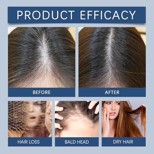 5% Minoxidil Spray for Men and Women Hair Growth – Hair Regrowth Serum with Ginger, Safflower and Black Sesame, Stop Hair Thinning and Hair Loss for Stronger Thicker Longer Hair, 60ml