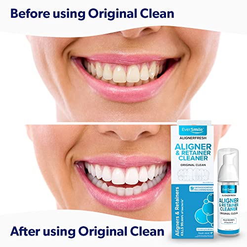 EverSmile AlignerFresh Original Clean AlignerFresh Cleaning Foam for