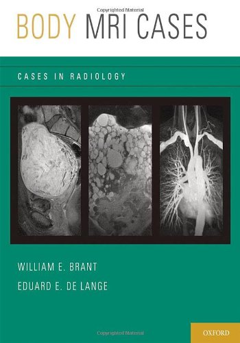 Body MRI Cases (Paperback)