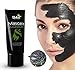 Mascara De Limpieza Facial Profunda Para Eliminar Espinillas - Mascarilla Negra De Purificacion Facial - Mascara De Barro Para La Cara