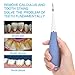 Dental Tools, OUZIGRT Teeth Cleaning Tools for Dental Calculus, Tartar, Tooth Stains, Plaque Removal, 5 Adjustable Modes (Gray-Blue)