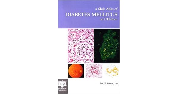 A Slide Atlas Of Diabetes Mellitus 9781842141830 Medicine - 