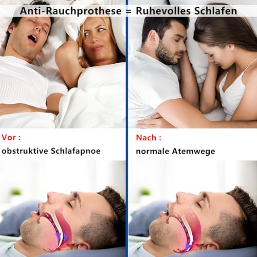 DOHUG Snore Splint, Adjustable Bite Splint Against Snoring and Crunching - Anti Snoring Snoring Stopper - Anti-Snoring Mouth Guard - Improves Sleep Quality (White Medium)