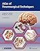 Atlas of Neurosurgical Techniques: Brain