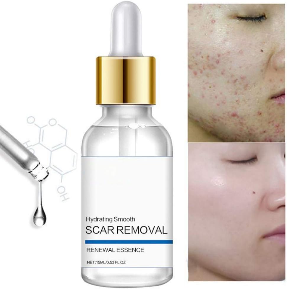 Traitement cicatrice,sérum cicatrice,scar oil,Traitement Crème,Gel pour Cicatrices,Crème