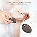Pumice Stone Lava Foot Scrubber - Airdom Natural Earth Volcanic Lava Wet Back Exfoliating Rock for Feet Heel Toe Scrubber Pedicure Massage Spa and Foot Dead Skin Callus Corn Remover Tool