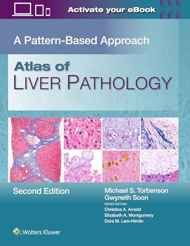 MacSween's Pathology of the Liver: 9780702082283: Medicine