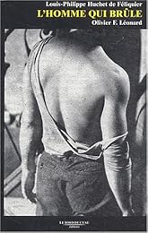 L' homme qui brûle