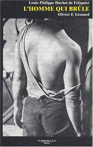 L' homme qui brûle