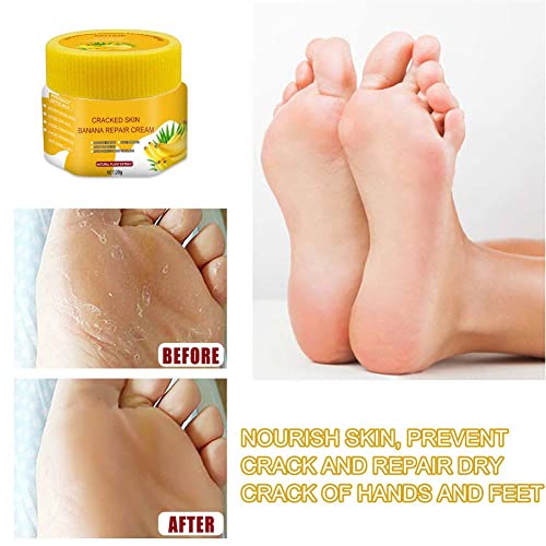 Dakbint Cracked Skin Banana Repair Cream Anti-fungal Peeling Cream