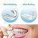 PHOEBE Mouth Guard for Grinding Teeth Night Guards for Teeth Grinding Mouldable Tooth Bite Guard Stop Teeth Grinding Clenching Eliminates Bruxism, TMJ -3 Sizes, 6 Pieces