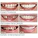 Lywey 1 Pair TOP & Buttom Temporary Smile Comfort Fit Cosmetic Teeth Denture Teeth Cosmetic Sticker Fashion Dental Removable