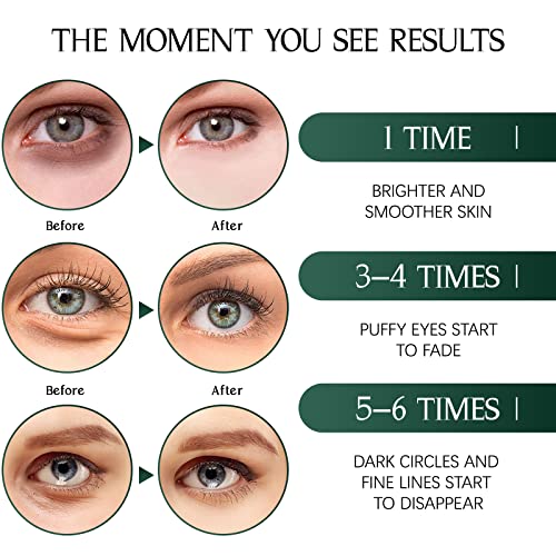 Green Tea Eye Collagen Patch Dark Circles and Bags, Anti Wrinkle, Remove Bags and Puffiness, Anti-Aging Moisturises, 30 Pairs