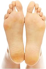 Citystores 3 Pack Pumice Stone for Feet Callus Remover Dry Cracked Heels view 5