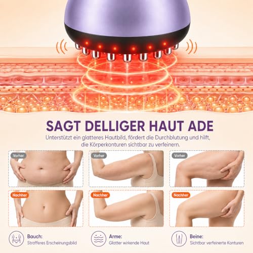 4 in 1 Electric Cellulite Massager, Cellulite Massage Device with 30 EMS Levels, Red Light, Heat & Vibration, Wireless Body Massager for Stomach, Waist, Arms, Legs