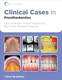 Clinical Cases in Prosthodontics (Clinical Cases (Dentistry))