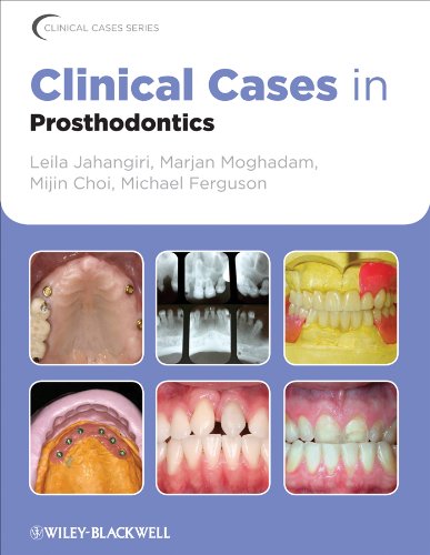 Clinical Cases In Prosthodontics