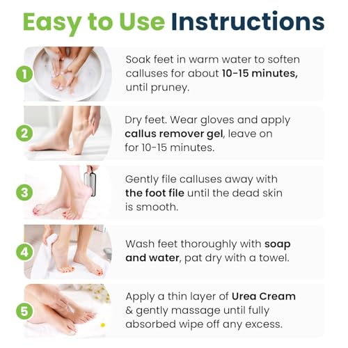 FOOT CURE Exfoliator & Callus Remover Pedicure Set – Care Kit Includes File for Dead Skin, Tea Tree Oil Soak Salts, Urea Cream 40 Percent Removal Gel Made in USA, Ivory, 4 Piece