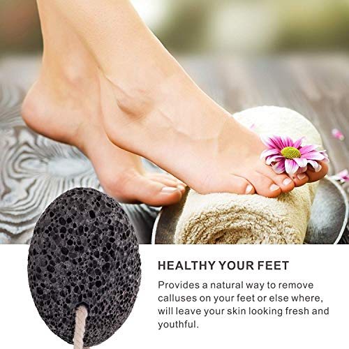 Natural Pumice Stone for Feet(Pack of 2), Chialstar Lava Pedicure Tools Hard Skin Callus Remover for Feet and Hands - Natural Foot File Exfoliation to Remove Dead Skin - Includes Bag and Suction Hook