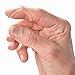 3-Point Products Oval-8 Finger Splint Combo Pack, Sizes 10, 11, 12, 13, 14