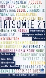 La  trisomie 21