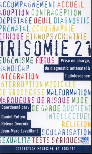 La  trisomie 21