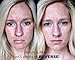 Rodan + Fields Reverse Regimen for Brown Spots, Dullness, and Sun Damage
