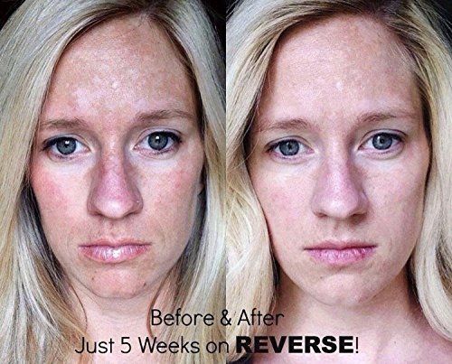 reverse brightening rodan and fields reviews