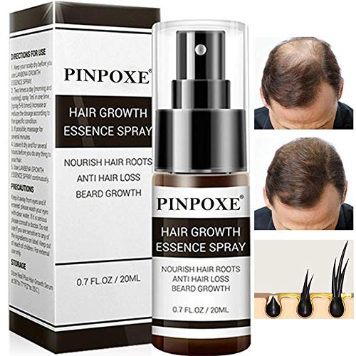 Hair Growth Product, Hair Regrowth, Hair Growth Essence Spray, Hair Loss Prevention, Hair Loss &Hair Thinning Treatment, Stimulates New Hair Growth, Best Treatment for Hair Loss