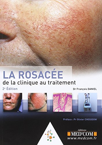 La  rosacée