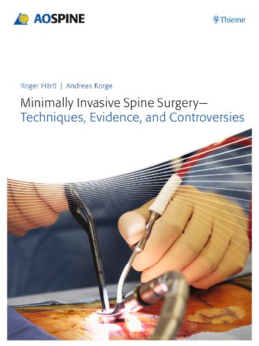 MINIMALLY INVASIVE SPINE SURGERY
