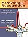 Arrhythmia Recognition: The Art of Interpretation: .