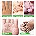 3 Pack Natural Peel Hand Repair Mask，Spa Gloves Deep Moisturizing Nourish Whitens for Dry Hands，Exfoliating Reduce Age Spots Repair Rough Damage Skinthumb 4