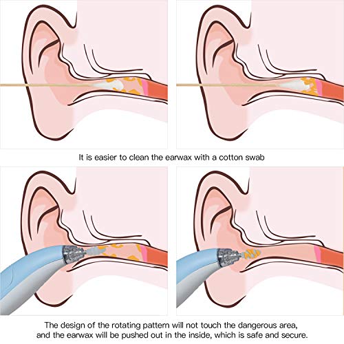 Ear Wax Removal Kit Spiral Tool, Ear Pick Cleaning Kit with LED Light, Ear Pick with 4 Silicone Spiral Tips for People of All Ages.