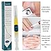 Toenail Fungus Treatment,Fungal Nail Gel,Fungus Stop,Nail Fungus Treatment Anti Fungal Nail Solution,Effective Against Nail Fungus