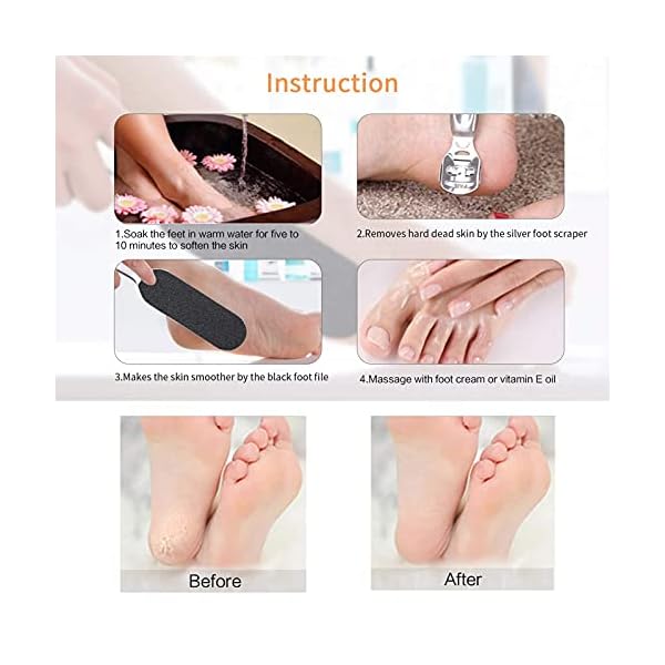 Canvalite-Pedicure-Foot-File-Foot-Scraper-Set-Rasp-Callus-Remover-Shaver-Professional-Stainless-Steel-Foot-Care-Tool-for-Hard-Dead-Skin Canvalite Pedicure Foot File Foot Scraper Set Rasp Callus Remover Shaver Professional Stainless Steel Foot Care Tool for…