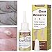 Corn Remover, Callus Remover, Callus Eliminator, Callus And Corn Remover Liquid, Professional Grade