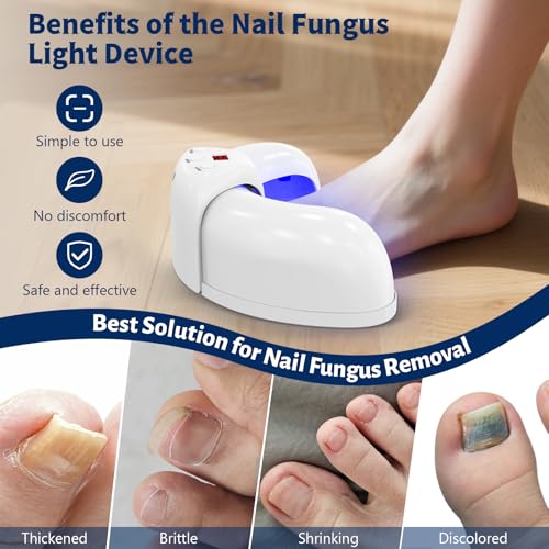 Fungal Nail Treatment Device for Toenails & Fingernails, LED Light Therapy for Discolored & Thick Nails, Adjustable Timer, Multi-Nail Design, Easy Home Use-Pure White
